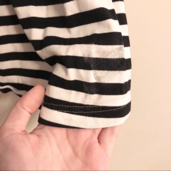 Marimekko Striped Button Front Tunic Dress - Picture 7 of 7
